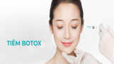 Những câu hỏi thường gặp về tiêm Botox