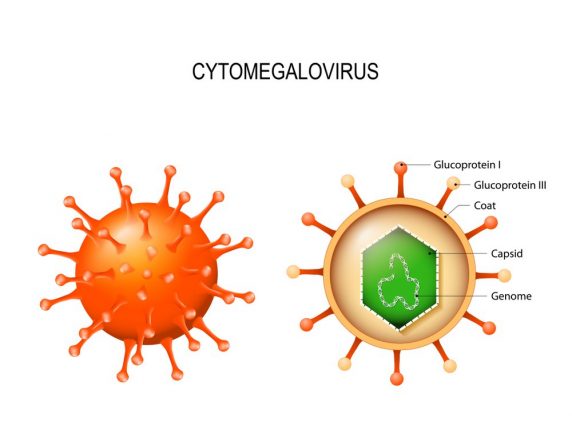 vien-vong-mac-do-Cytomegalovirus 