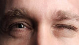 Nguyên nhân và cách điều trị chứng co giật ở mắt