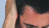 Đau nhức vùng đầu phía sau mắt: Nguyên nhân và cách điều trị