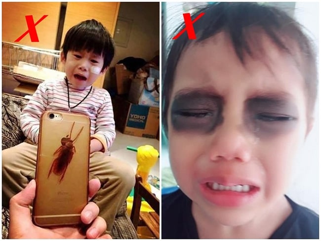 Trẻ xem điện thoại quá mức dẫn đến đui cả hai mắt